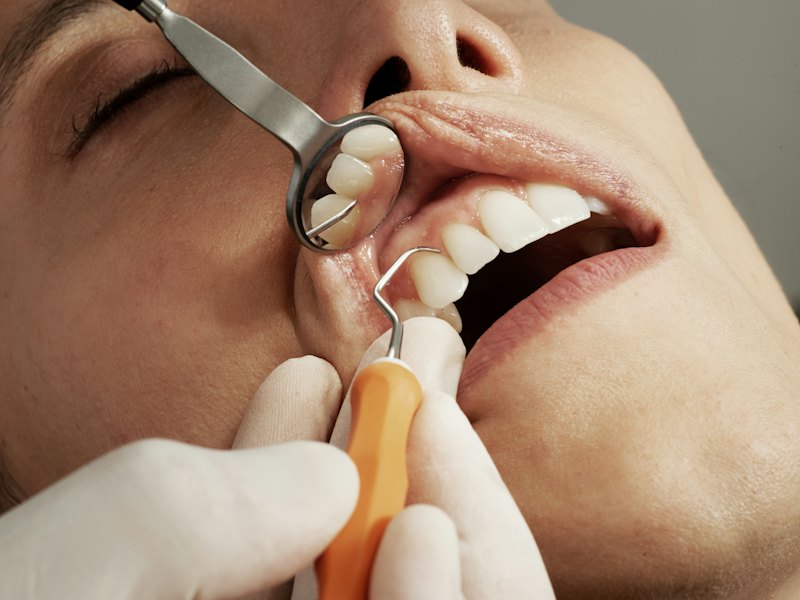 A dental check-up